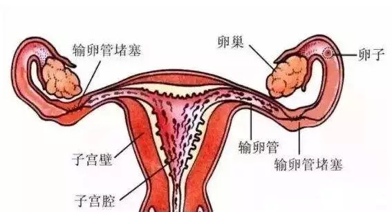 哪些情况下需要进行输卵管造影检查？